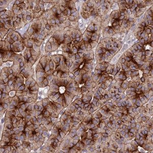 Anti-C11orf68 antibody produced in rabbit 