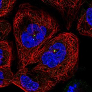 Anti-C11orf80 antibody produced in rabbit HPA038933-100UL