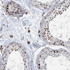 Anti-C11orf84 antibody produced in rabbit 
