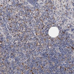 Anti-C11orf84 antibody produced in rabbit 