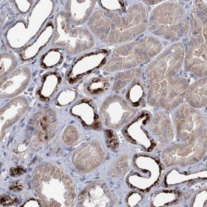 Anti-C11orf86 antibody produced in rabbit 