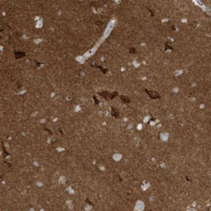 Anti-C11orf87 antibody produced in rabbit 