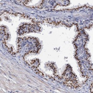 Anti-C11orf96 antibody produced in rabbit 