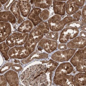 Anti-C12orf4 antibody produced in rabbit 
