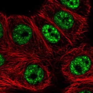 Anti-C12orf57 antibody produced in rabbit 
