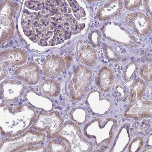 Anti-C12orf66 antibody produced in rabbit HPA046743-100UL