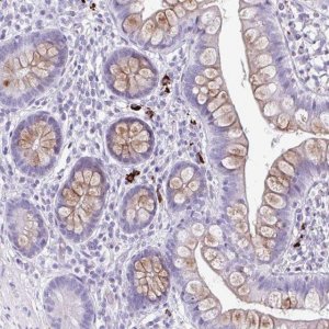 Anti-C12orf71 antibody produced in rabbit 