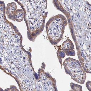 Anti-C12orf73 antibody produced in rabbit 