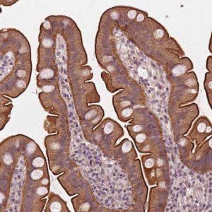 Anti-C14orf79 antibody produced in rabbit 