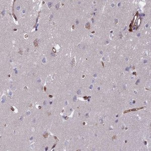 Anti-C15orf59 antibody produced in rabbit 