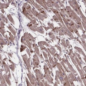 Anti-C15orf65 antibody produced in rabbit 