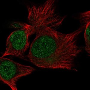 Anti-C15orf65 antibody produced in rabbit 