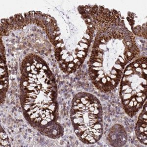 Anti-C16orf54 antibody produced in rabbit 