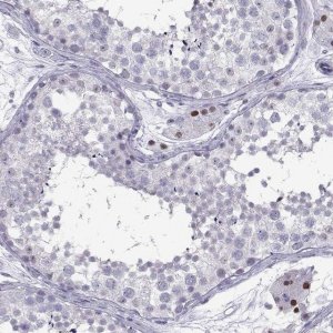 Anti-C16orf59 antibody produced in rabbit 