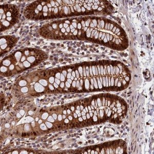 Anti-C16orf70 antibody produced in rabbit 