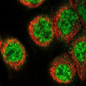 Anti-C16orf70 antibody produced in rabbit 