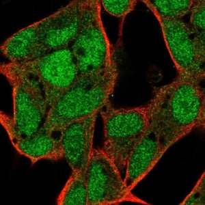 Anti-C17ORF100 antibody produced in rabbit 