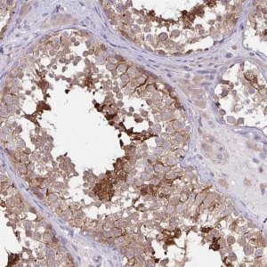 Anti-C17orf105 antibody produced in rabbit 