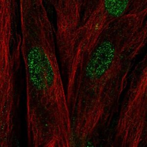 Anti-C17orf107 antibody produced in rabbit 