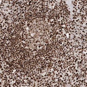 Anti-C17ORF49 antibody produced in rabbit 