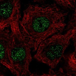 Anti-C17orf50 antibody produced in rabbit 