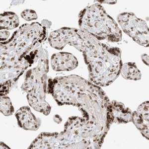 Anti-C17orf58 antibody produced in rabbit 