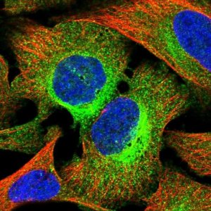 Anti-C17orf58 antibody produced in rabbit 