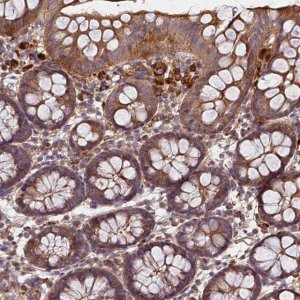 Anti-C17ORF62 antibody produced in rabbit 