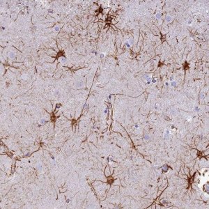Anti-C17orf67 antibody produced in rabbit 