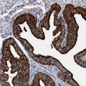Anti-C17orf74 antibody produced in rabbit 