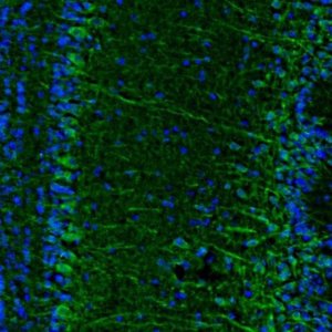 Anti-C17orf75 antibody produced in rabbit 