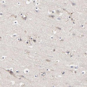 Anti-C17orf75 antibody produced in rabbit 