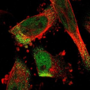 Anti-C17orf80 antibody produced in rabbit HPA012896-100UL