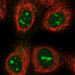 Anti-C17orf97 antibody produced in rabbit 