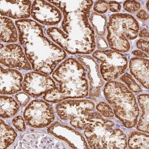 Anti-C17orf98 antibody produced in rabbit 