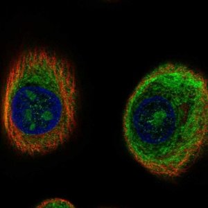 Anti-C17orf98 antibody produced in rabbit 