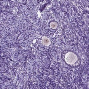 Anti-C18orf21 antibody produced in rabbit 