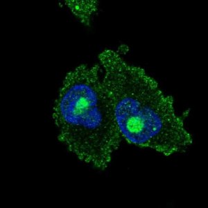 Anti-C18orf21 antibody produced in rabbit 