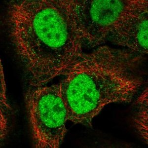 Anti-C18orf25 antibody produced in rabbit 