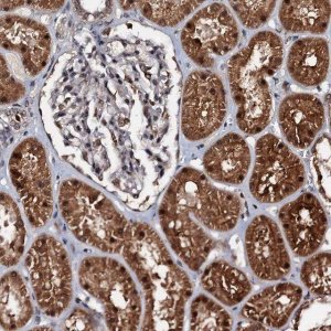Anti-C18orf32 antibody produced in rabbit 