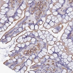 Anti-C18ORF8 antibody produced in rabbit HPA043589-100UL