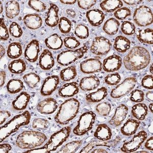 Anti-C19orf24 antibody produced in rabbit 