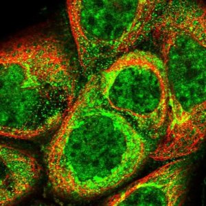 Anti-C19orf24 antibody produced in rabbit 