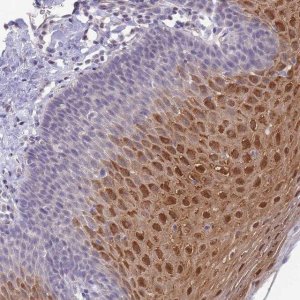 Anti-C19ORF25 antibody produced in rabbit HPA050270-100UL