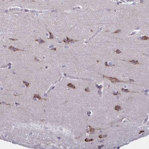 Anti-C19orf35 antibody produced in rabbit 