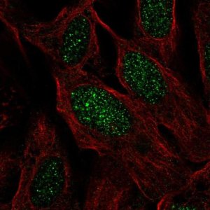 Anti-C19orf44 antibody produced in rabbit 