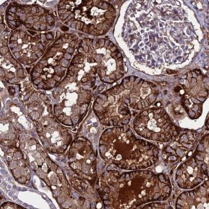 Anti-C19orf60 antibody produced in rabbit 
