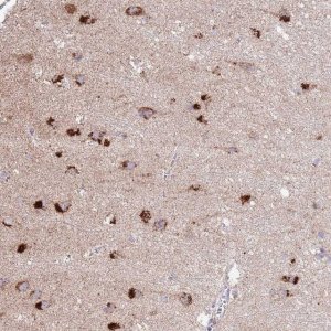 Anti-C19ORF71 antibody produced in rabbit HPA048654-100UL