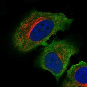 Anti-C19ORF71 antibody produced in rabbit HPA048654-100UL