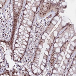 Anti-C1D antibody produced in rabbit 